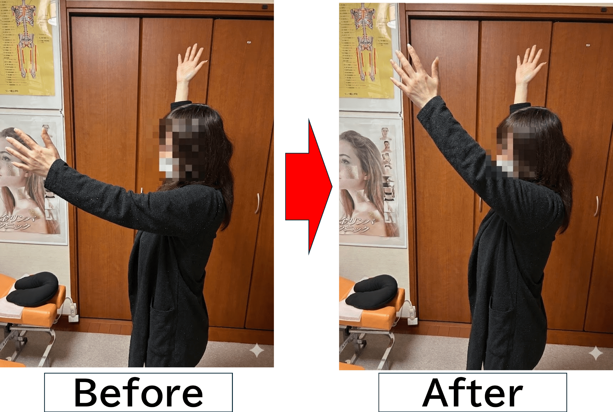 施術事例イメージ
